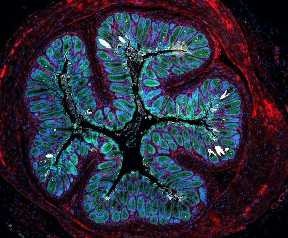 gut microbiota